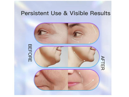 Masajeador facial lifting EMS- Limpieza con 3 Luces LED